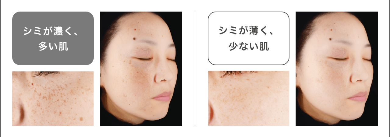 ONE BY KOSE Melanoshot W Brightening Serum - Сыворотка для снижения пигментации