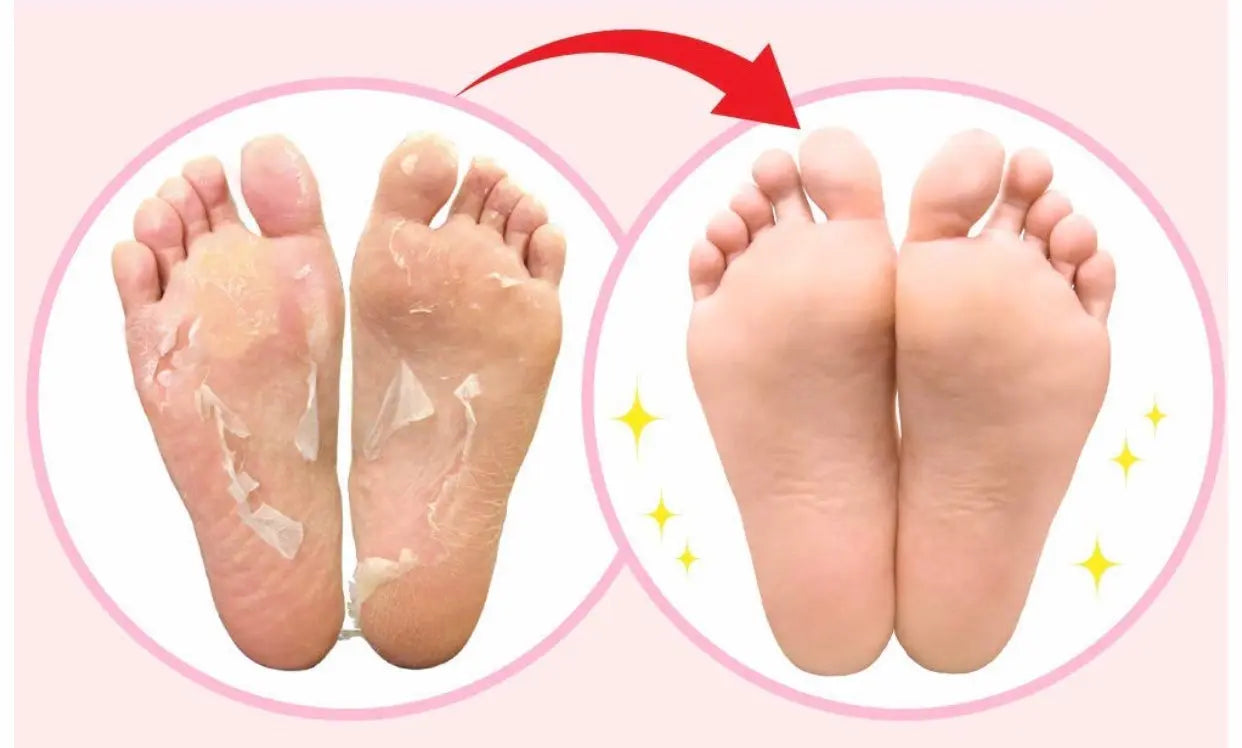 Педикюрные носочки - Ana Beauty Japan